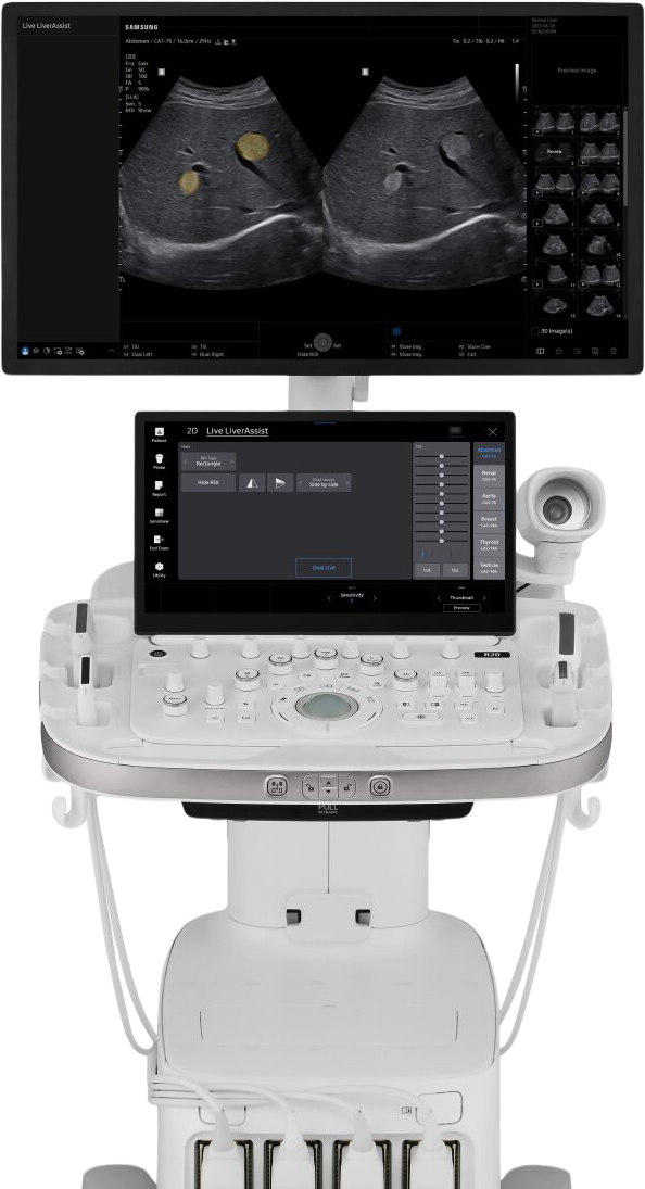 Ecógrafo Samsung R20